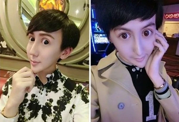 Hết hồn chàng trai giống yêu tinh vì phẫu thuật thẩm mỹ