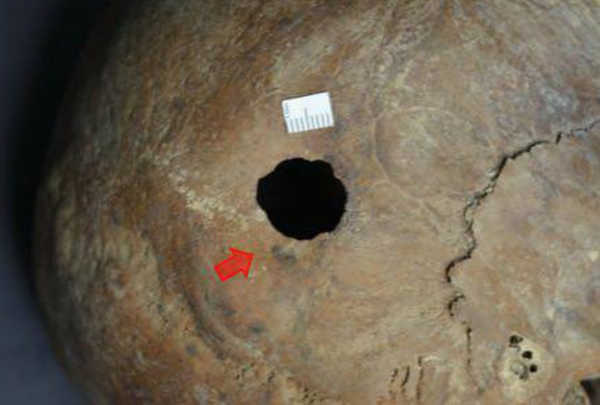 Khi mở quan tài ra, người ta tìm thấy bộ hài cốt người, trong đó, phần sọ bị khoan một lỗ bí ẩn. Ảnh: @Bộ Cổ Vật Ai Cập.