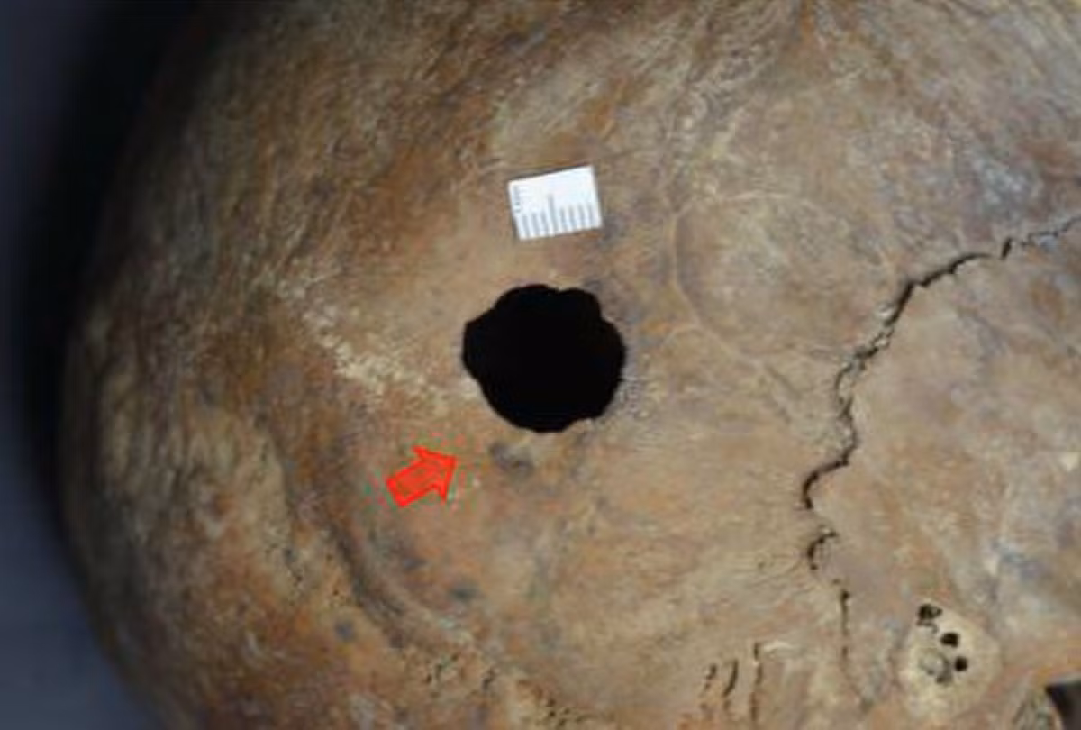 Khi mở quan tài ra, người ta tìm thấy bộ hài cốt người, trong đó, phần sọ bị khoan một lỗ bí ẩn. Ảnh: @Bộ Cổ Vật Ai Cập.