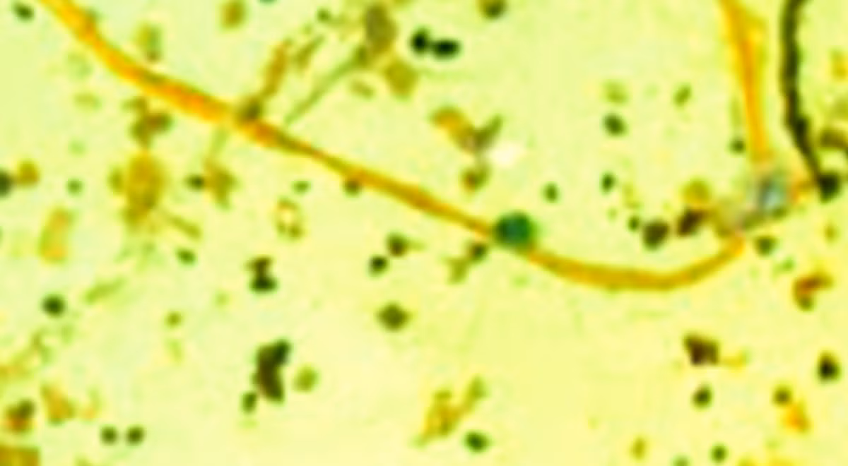 Tiến sĩ Bo Wang, một nhà nghiên cứu tại Viện Địa chất và Cổ sinh vật học Nam Kinh thuộc Viện Hàn lâm Khoa học Trung Quốc, cho biết: "Hồ sơ hóa thạch của sán dây biển cổ đại cực kỳ ít ỏi do mô mềm và môi trường sống ký sinh của chúng, điều này từng cản trở rất nhiều đến sự hiểu biết của chúng ta về quá trình tiến hóa ban đầu của chúng". Ảnh: @Viện Hàn lâm Khoa học Trung Quốc.