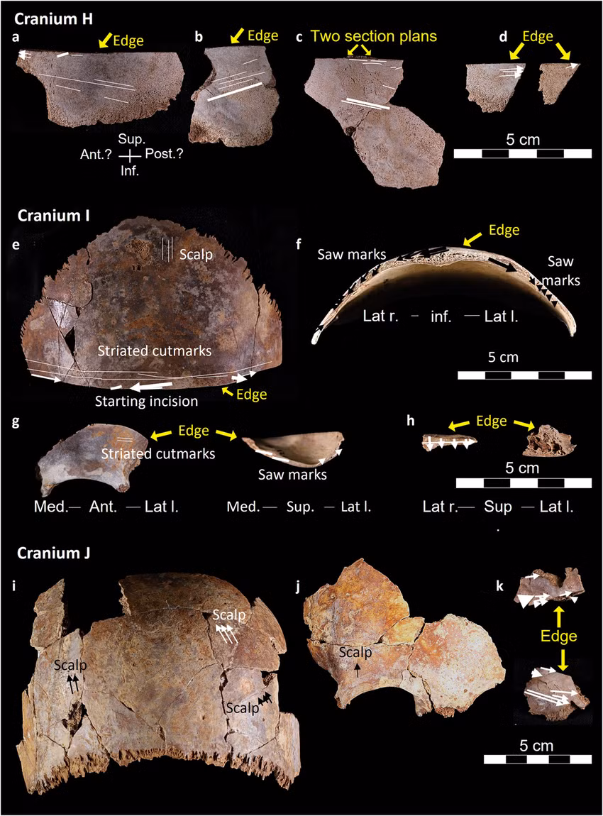 Những bằng chứng này chỉ ra rằng, kỹ thuật ướp xác đã được sử dụng trong giới quý tộc Châu Âu trong thế kỷ 16 và 17, và khám phá này sẽ cung cấp những hiểu biết quan trọng về phương pháp ướp xác đầu tiên trong lịch sử Châu Âu. Ảnh: @Viện Hàn lâm Khoa học Áo (ÖAW).