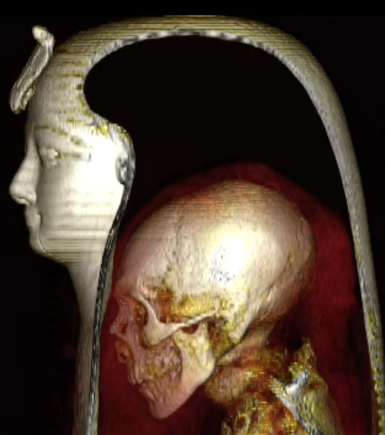 Giờ đây, Nhà thiết kế 3D người Brazil, Cicero Moraes, chuyên về tái tạo khuôn mặt pháp y, một lần nữa dẫn đầu dự án tái tạo kỹ thuật số khuôn mặt của Amenhotep I. Ảnh: @Cicero Moraes.