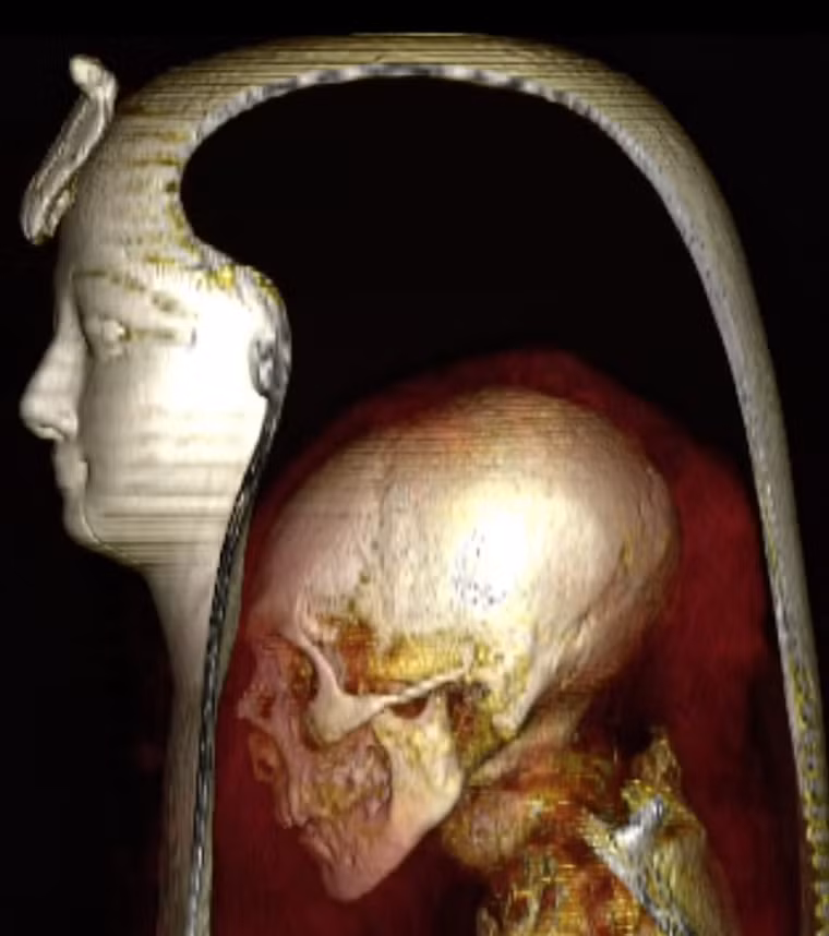 Giờ đây, Nhà thiết kế 3D người Brazil, Cicero Moraes, chuyên về tái tạo khuôn mặt pháp y, một lần nữa dẫn đầu dự án tái tạo kỹ thuật số khuôn mặt của Amenhotep I. Ảnh: @Cicero Moraes.