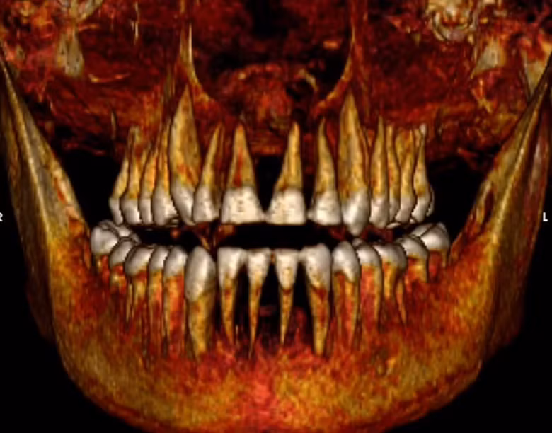 Những hình ảnh chụp này cũng xác nhận rằng. Amenhotep I cao khoảng 1,67 mét và có hàm răng được bảo quản tốt. Mặc dù các cuộc quét hình ảnh không thể xác định nguyên nhân tử vong. Ảnh: @Cicero Moraes.