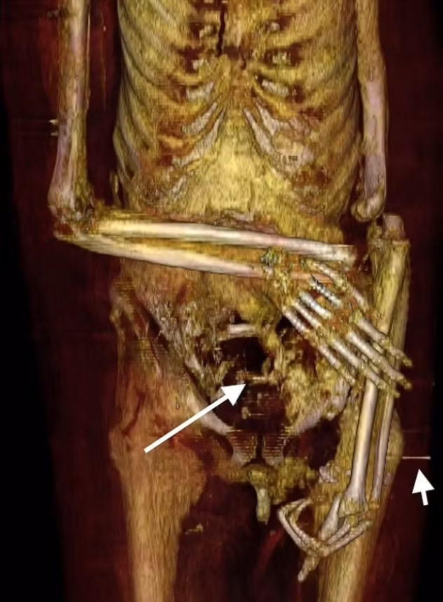 Sử dụng các kỹ thuật tiên tiến nhất, Moraes đã kết hợp dữ liệu từ nhiều nguồn khác nhau, bao gồm cả ảnh chụp cắt lớp vi tính (CT) hộp sọ của pharaoh này. Kết quả chụp CT đã tiết lộ những chi tiết quan trọng về ngoại hình của pharaoh, bao gồm cấu trúc xương và một số cơ quan nội tạng được bảo quản tốt như tim và não. Ảnh: @Cicero Moraes.