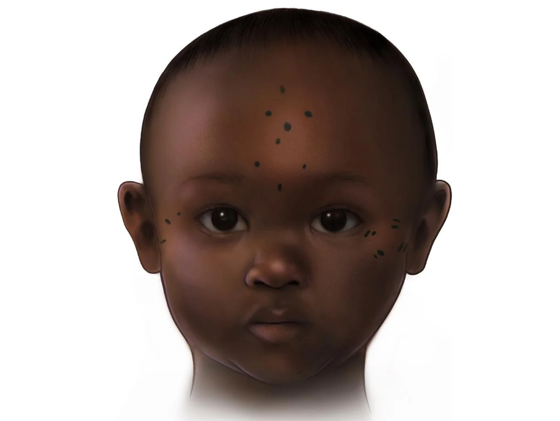 Kết quả cho thấy, đó là những chấm hình xăm trên khuôn mặt đứa trẻ. Ảnh: @Đại học Missouri-St. Louis.