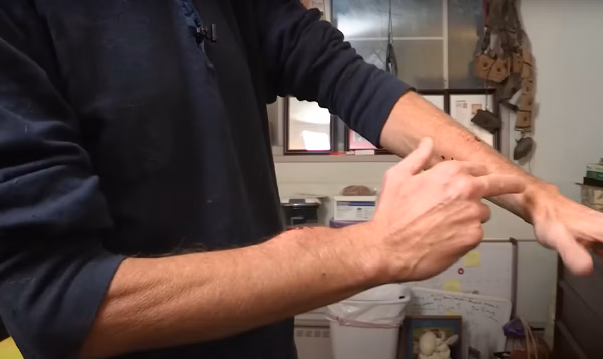 Tổng cộng, Tim Friede đã phải chịu hơn 200 vết rắn cắn và 856 mũi tiêm nọc độc rắn do ông chuẩn bị từ một số loài rắn độc nhất thế giới, bao gồm rắn mamba, rắn hổ mang, rắn taipan và rắn cạp nong. Ảnh: @Truly.