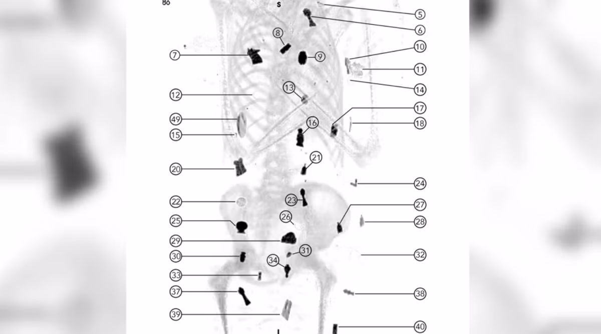 Các lá bùa hộ mệnh được đặt bên trong khoang cơ thể của xác ướp. Ảnh: @Đại học Cairo.