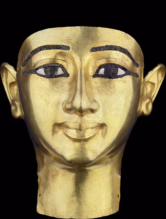 Ngoài ra, các nhà khảo cổ học cũng tìm thấy bằng chứng về tình trạng nhiễm trùng nướu nghiêm trọng trên xác ướp này. Nghiên cứu không tập trung vào nguyên nhân cái chết của xác ướp, nhưng đặc điểm của hộp sọ cho thấy nó thuộc về một người đàn ông trưởng thành, qua đời ở độ tuổi đôi mươi. Ảnh: @Bảo tàng Khảo cổ học Quốc gia Athens.