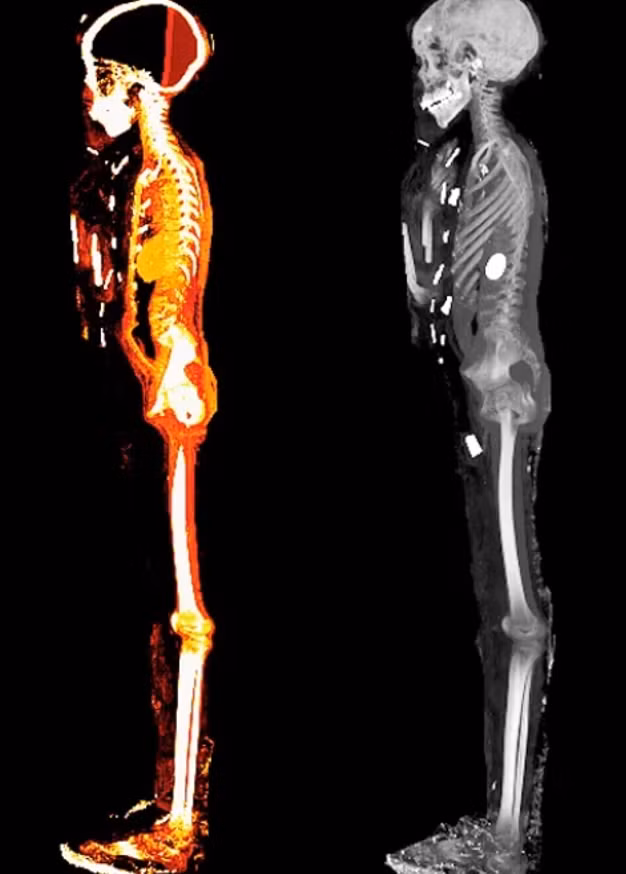 Các hình chụp CT cũng cho thấy 'cậu bé vàng' cao 128 cm, khoảng 14 đến 15 tuổi và không có nguyên nhân tử vong nào được biết đến. Ảnh: @Đại học Cairo.