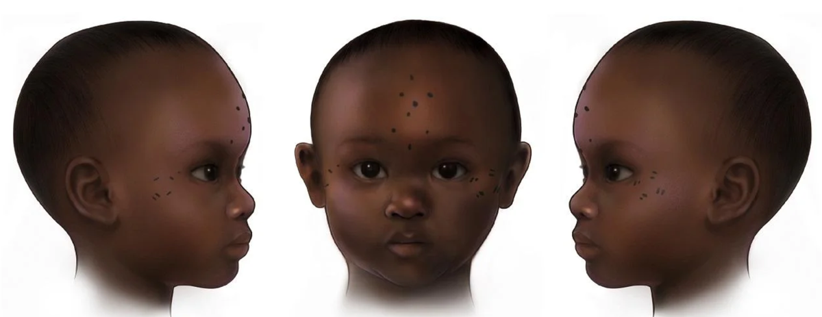 Việc xuất hiện hình xăm trên cơ thể trẻ nhỏ, đặc biệt là trẻ dưới ba tuổi, trong bộ xác ướp đã làm dấy lên nhiều câu hỏi về mục đích thực sự của những hình xăm này. Ảnh: @Đại học Missouri-St. Louis.