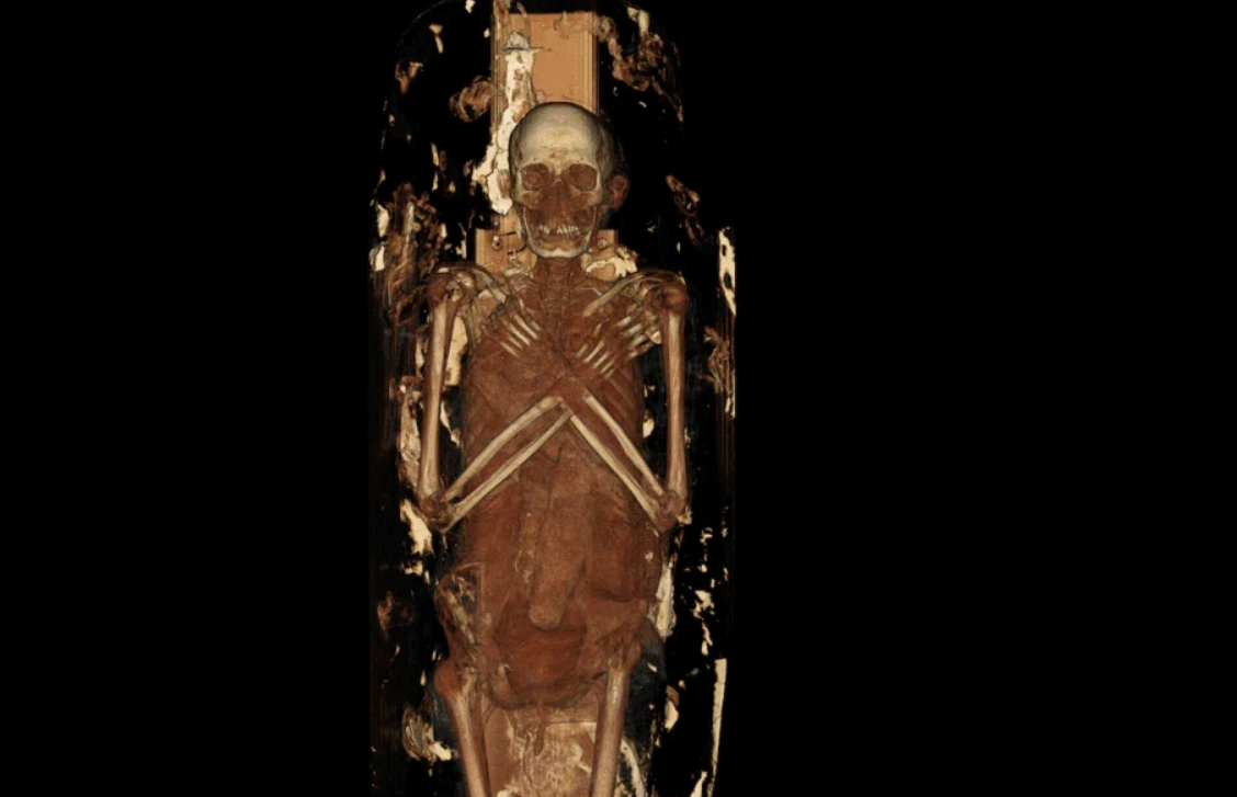 Những đặc điểm này mang lại cái nhìn rõ ràng hơn về diện mạo cá nhân thay vì một hình ảnh được bọc kín. Các kết quả chụp chiếu cũng ghi nhận những dấu hiệu lão hóa và bệnh tật. Nes Min cho thấy tổn thương ở phần cột sống thắt lưng. Một đốt sống thắt lưng đã bị xẹp, một dạng tổn thương liên quan đến sự căng thẳng lâu dài và hao mòn do tuổi tác. Ảnh: @Đại học Nam California.