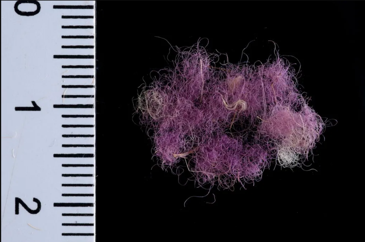 Đó là miếng vải nhuộm màu tím hoàng gia, ước tính có niên đại khoảng 3.000 năm tuổi, thuộc thời vua David. Ảnh: @Cơ quan Cổ vật Israel.