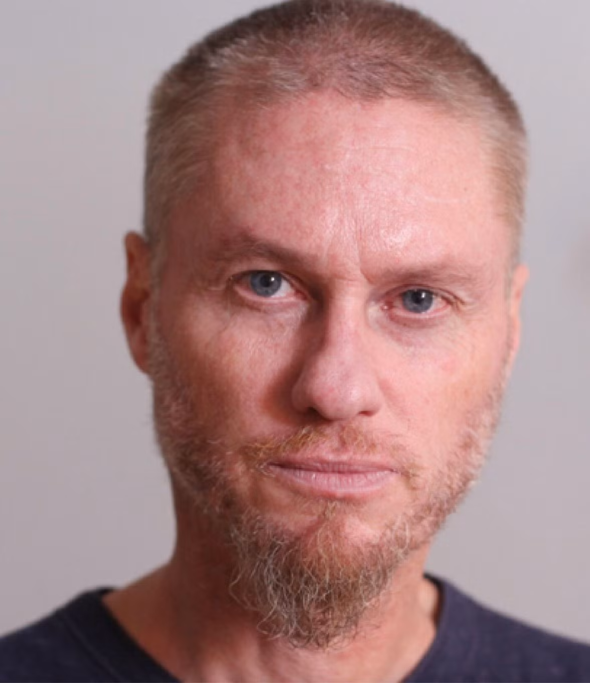 Với hy vọng bảo vệ bản thân khỏi bị rắn cắn và vì cái mà Tim Friede gọi là "sự tò mò đơn thuần", ông ấy bắt đầu tiêm cho mình những liều nọc rắn nhỏ, rồi từ từ tăng liều lượng lên để tăng khả năng sức chịu đựng của cơ thể. Sau đó, ông ấy để rắn cắn mình. Ảnh:@Centivax.