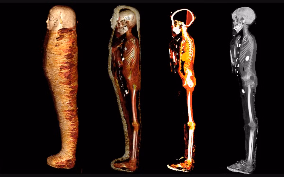 Để hiểu rõ hơn, nhóm nghiên cứu đã sử dụng phương pháp chụp cắt lớp vi tính (CT) để khai mở các bí mật có trong xác ướp này. Tiến sĩ Sahar Saleem tại Khoa Y của Đại học Cairo, Ai Cập cho biết, kết quả chụp CT cho thấy trong xác ướp, ngoại trừ trái tim, nội tạng đã được người cổ xưa lấy ra qua một vết rạch, thì phần não đã được lấy ra qua mũi và thay thế bằng nhựa thực vật. Ảnh: @Đại học Cairo.