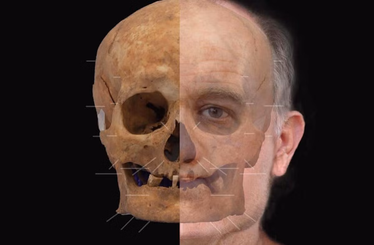 Lúc sống, ông ấy được cho là mắc các vấn đề nghiêm trọng về răng miệng và đau khớp. Ảnh: @Bảo Tàng Quốc Gia Scotland.