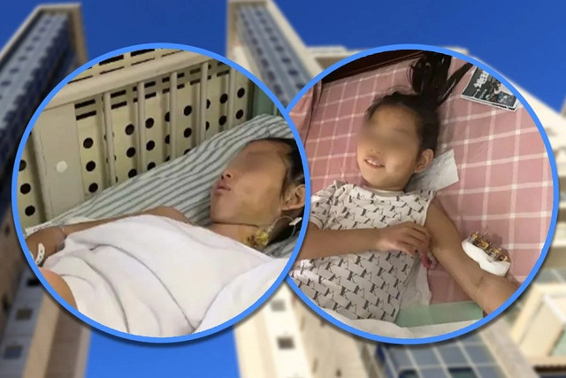 Bé gái 9 tuổi ở Trung Quốc đã sống sót kỳ diệu sau khi rơi từ tầng 25 xuống tầng 7 của một tòa nhà. Ảnh: SCMP. nga2.png
