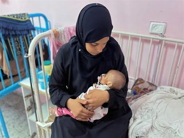 Hơn 80 trẻ em ở Gaza đã chết vì đói. Ảnh: Tasnim. ga.png