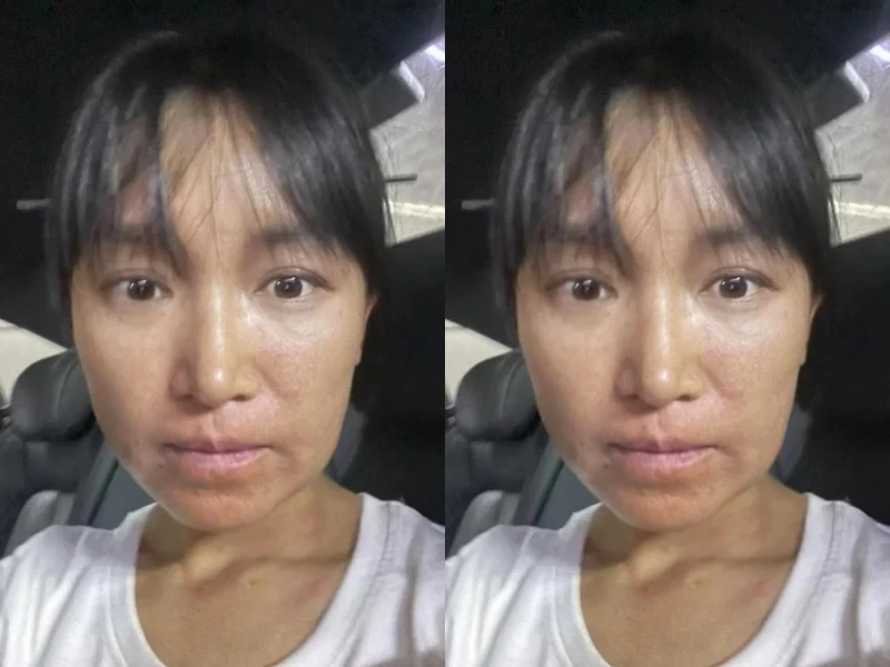 Lý Tử Thất lộ ảnh cận gương mặt làm fan lo lắng