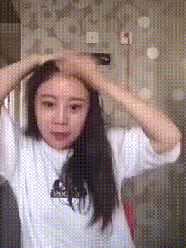 Ngay sau sự cố với màn ăn ngô tốc độ, cô nàng vẫn bình tĩnh khoe mái đầu mất mảng tóc của mình. Được biết, ngay sau đó cô đã phải tìm tới một bác sĩ thẩm mỹ để cấy lại tóc.