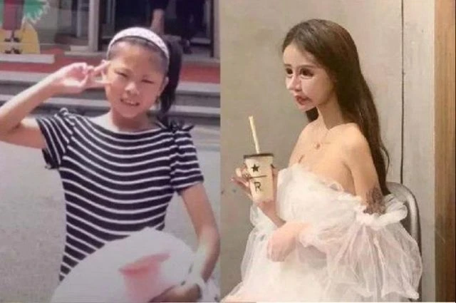 Choáng với gương mặt "hot girl mặt rắn", phẫu thuật từ 13 tuổi