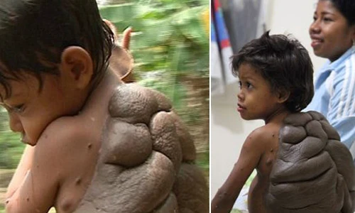 10 ca dị tật kinh dị nhất thế giới