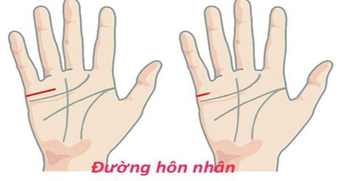 Đường chỉ tay hôn nhân ngắn. Đường chỉ tay hôn nhân là đường nằm ngay sát mép bàn tay, dưới ngón út. Đường chỉ tay hôn nhân nếu ngắn hơn bình thường thì có nghĩa là người đó không giao du với những người không có giá trị sử dụng.