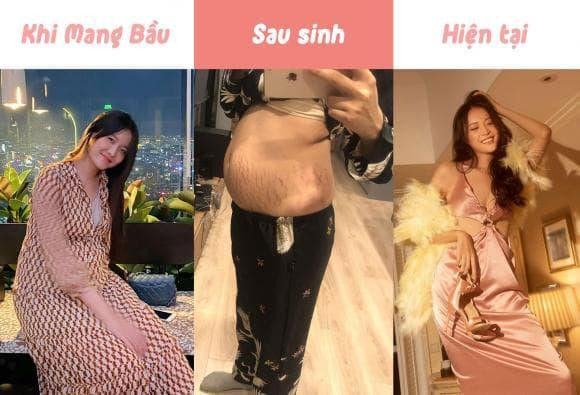 au đó, nàng Á hậu tiếp tục công khai quá trình mang nặng đẻ đau cùng những vết tích rạn da do bầu bí. Chân dài không ngại công khai hình ảnh sau khi đẻ xong bụng đầy khuyết điểm: "Có mẹ nào mới đẻ xong mà cái bụng vẫn còn to và nứt giống Nhân không? Sanh xong mà bụng vẫn to và béo vậy hơi bị sốc luôn". Người hâm mộ không khỏi xót xa bởi những vết rạn này sẽ ảnh hưởng rất nhiều đến vẻ ngoài của nữ diễn viên.