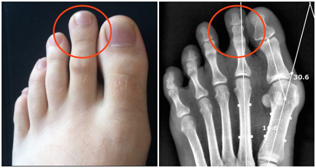 Tuy nhiên, nếu gác điều đó sang một bên, bạn là người năng động, sáng tạo và nhiệt tình, trở thành một lựa chọn tốt để giao vai trò lãnh đạo. Bạn luôn sẵn sàng cho những thử thách và dự án mới. Bạn là người rất thích thể thao, thích sáng tạo và tìm tòi những điều mới mẻ. Trong công việc, bạn rất nghiêm túc và luôn cố gắng vì gia đình.