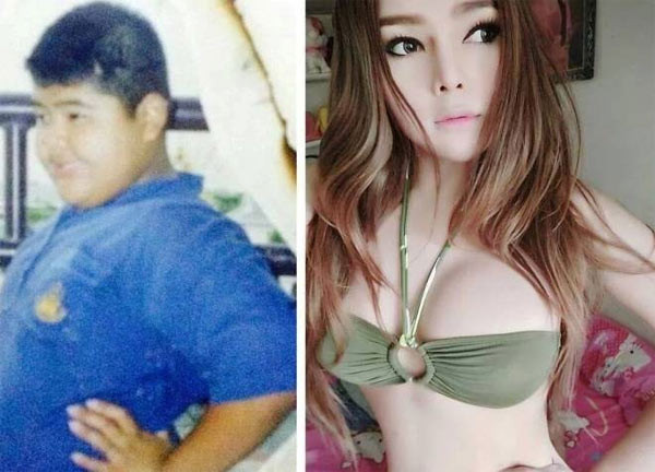 Hot girl chuyển giới Thái Lan bất ngờ gây sốt cộng đồng mạng châu Á sau khi công bố những bức ảnh trái ngược nhau hoàn toàn lúc trước và sau phẫu thuật thẩm mỹ. Theo đó, từ một cậu bé béo ú, đen đúa, cô đã trở thành con gái với nước da trắng, xinh đẹp. Thậm chí nhờ vậy, cô còn vào top 10 câu chuyện chấn động và 10 bạn trẻ gây chú ý nhất Thái Lan trong năm 2014.