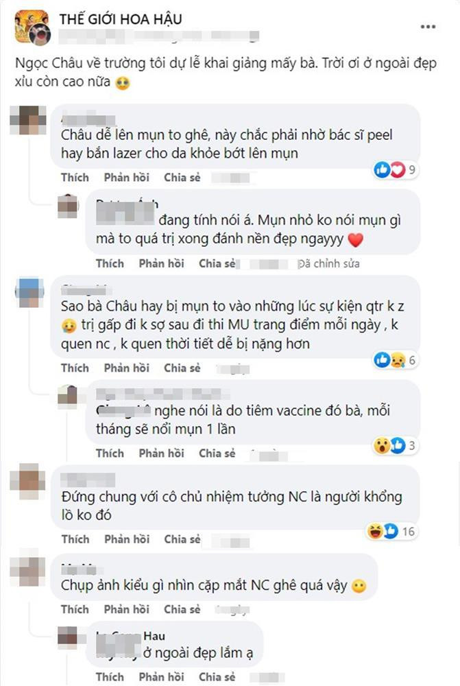 oạt bình luận của dân mạng: "Châu dễ lên mụn to ghê, chắc phải nhờ bác sĩ peel hoặc bắn lazer", "Sao bà Châu hay bị mụn vào những sự kiện quan trọng vậy, trị gấp đi không sợ sau thi Miss Universe phải trang điểm mỗi ngày, dễ bị nặng hơn",...