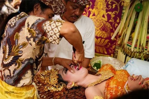 Tục mài răng: Đây là một trong những nghi thức tôn giáo lớn nhất của người theo đạo Hindu. Tại Bali, răng thường được mài nhẵn vì người dân ở đây coi răng đại diện cho sự tức giận, ghen tuông, và cảm xúc tiêu cực tương tự khác. Nghi thức này dành cho cả nam giới, phụ nữ và được thực hiện trước khi kết hôn hoặc tiến hành trong lễ cưới.