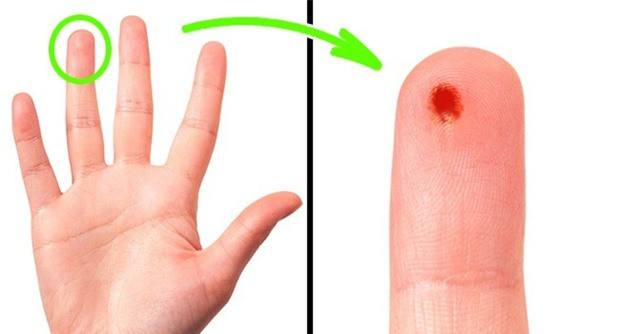 8. Tại sao khi lấy máu để thử chỉ lấy ở ngón áp út. Vì ngón cái và ngón út là 2 ngón có mạch máu nối đến toàn bộ mạng lưới ở cổ tay, cho nên các bác sỹ đều khuyến nghị không "động chạm" gì đến 2 ngón đó. Nếu có sai sót lây truyền gì thì sẽ ảnh hưởng đến cả phần cánh tay của bạn. Ngoài ra, ngón áp út là ngón ít đau nhất.