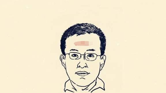 4. Sống mũi ngắn, cánh mũi tẹt và nhỏ. Về nhân tướng học, mũi là cung của phú quý, nhung lụa, chủ về sự giàu sang và tương lai của một người. Nếu là người có đầu mũi tẹt, thì người này nói chung thiếu tự tin, ý thức kém, không có chính kiến, khó có bước đột phá và phát triển, dễ nghe người khác gièm pha. Thành quả lao động dễ bị kẻ khác cướp mất, dễ bị lừa gạt, cuộc sống không tốt, không tiết kiệm được, cuộc sống khó khăn lắm!