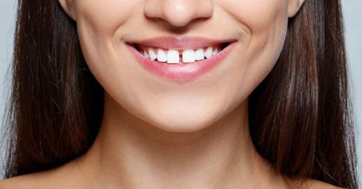 Phụ nữ có tướng răng lộn xộn. Ông bà ta từ xưa thường có câu “cái răng cái tóc là gốc con người”, thế nên chỉ cần nhìn vào hàm răng cũng có thể đoán biết được tính cách của một người. Nếu may mắn sở hữu hàm răng đều, trắng chủ nhân là người cẩn trọng, chu đáo và có cuộc sống thuận lợi, bình yên.