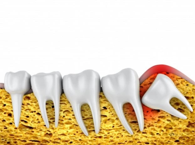 5. Một số bộ phận cơ thể đã hoặc sẽ biến mất: Có những người sinh ra không có răng khôn do kích thước hàm giảm dần, là kết quả của việc thay đổi trong chế độ ăn uống. Một bộ phận khác cũng không có ở 10% - 15% dân số thế giới là palmaris longus (cơ gan tay).