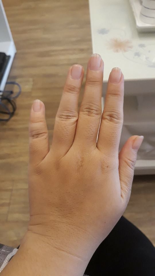 Bên cạnh đó, người sở hữu ngón tay thô cũng rất thật thà, có sao nói vậy và thích giúp đỡ người khác nên đi đến đâu cũng được người xung quanh yêu mến. Nếu như họ gặp nhiều vất vả khi còn trẻ thì đến tuổi trung niên, sự nghiệp cũng như cuộc sống của họ là điều mà nhiều người mơ ước. (* Thông tin trong bài mang tính tham khảo, chiêm nghiệm).