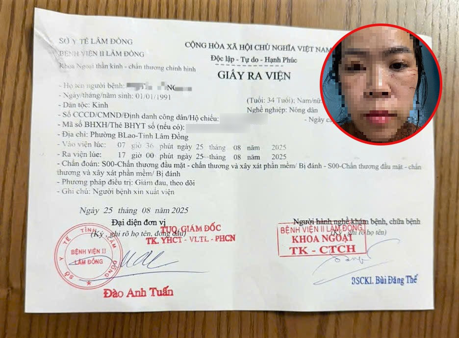 Chị H. bị hành hung chấn thương phần mềm ở phần đầu, mặt phải nhập viện theo dõi 1 ngày. (Ảnh: Báo Lâm Đồng) 