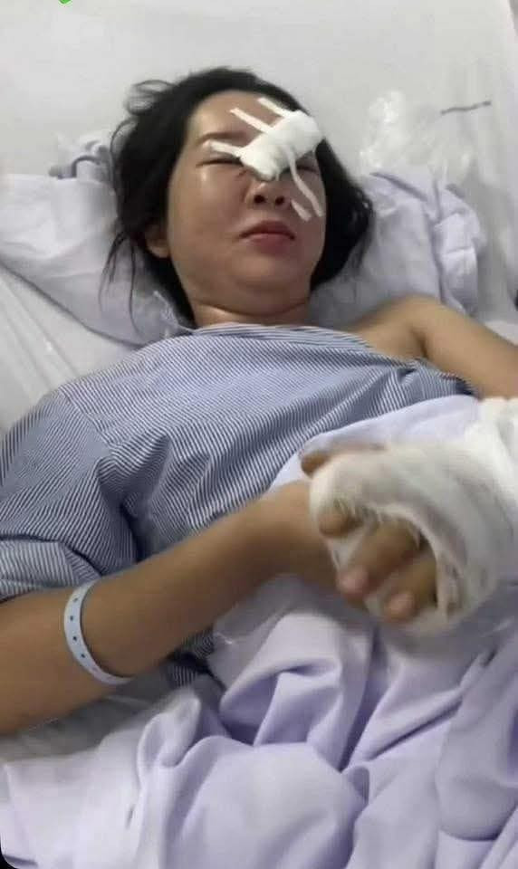 Chị Đỗ Thị Thảo đang điều trị tại bệnh viện với 2 vết thương ở vùng mặt và tay phải.