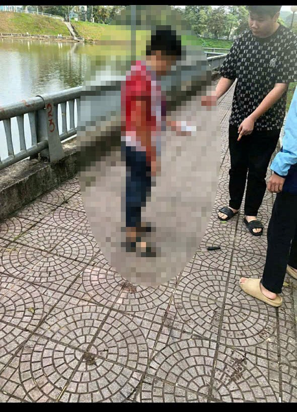 Hình ảnh cháu bé với nhiều vết thương trên người. Ảnh: Người dân cung cấp