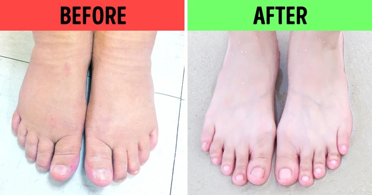 10 cách ngâm chân giúp trị một số vấn đề sức khỏe khó chịu