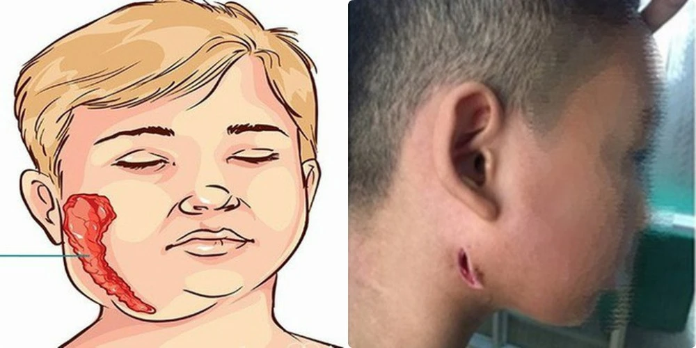 Những căn bệnh chết người “ám ảnh” nhất năm 2019