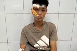 Khởi tố vụ án, điều tra tội giết người vụ thông chốt A80