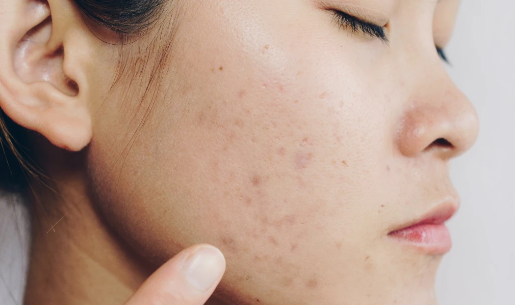 5 dấu hiệu trên mặt tố cáo cơ thể đầy bệnh tật cần khám ngay