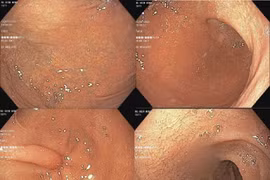 Người phụ nữ phát hiện mắc cùng lúc 6 bệnh lý khác nhau khi đi khám 