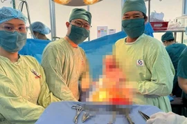 Phẫu thuật thành công cho sản phụ mắc hội chứng hiếm Budd-Chiari