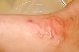 Bệnh giun sán gia tăng tại Khánh Hòa, nguy cơ từ nuôi chó mèo