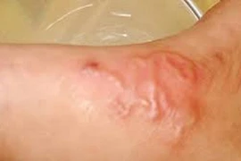 Bệnh giun sán gia tăng tại Khánh Hòa, nguy cơ từ nuôi chó mèo