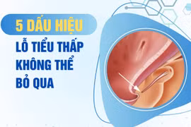 Bác sĩ chỉ cách nhận diện 5 dấu hiệu lỗ tiểu thấp ở trẻ 