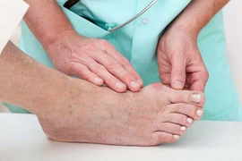 Bác sĩ cảnh báo tự ý dùng corticoid trị gout có thể gây tàn phế